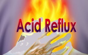 Acid Reflux